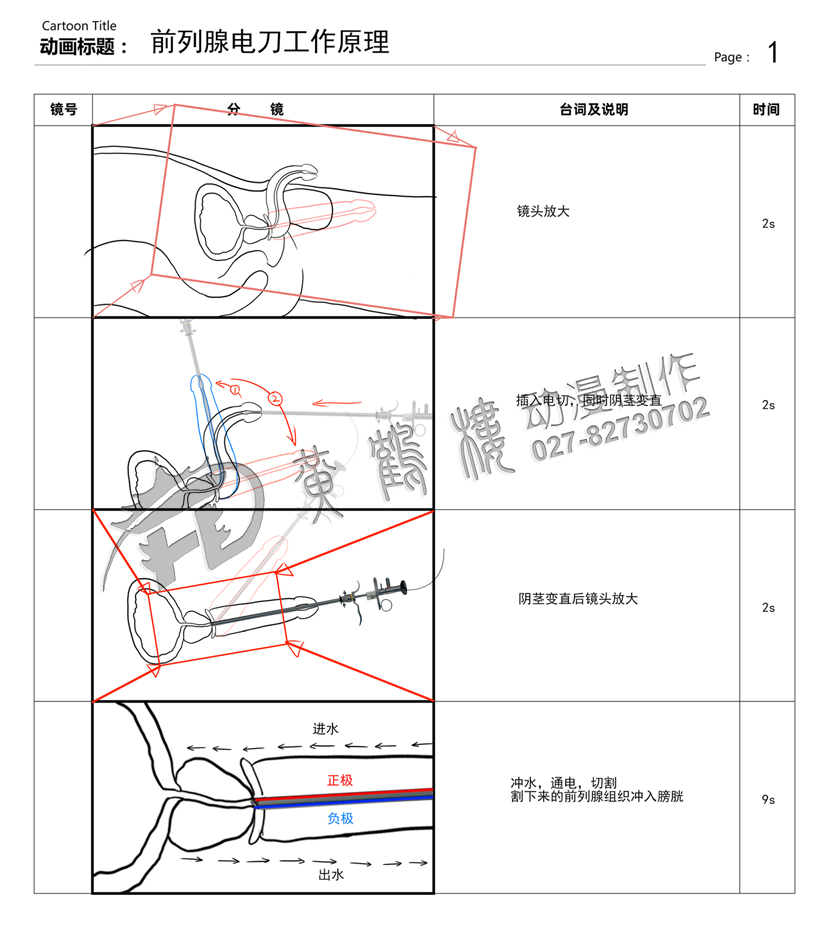 前列腺电切工作原理医疗手术动画分镜头设计