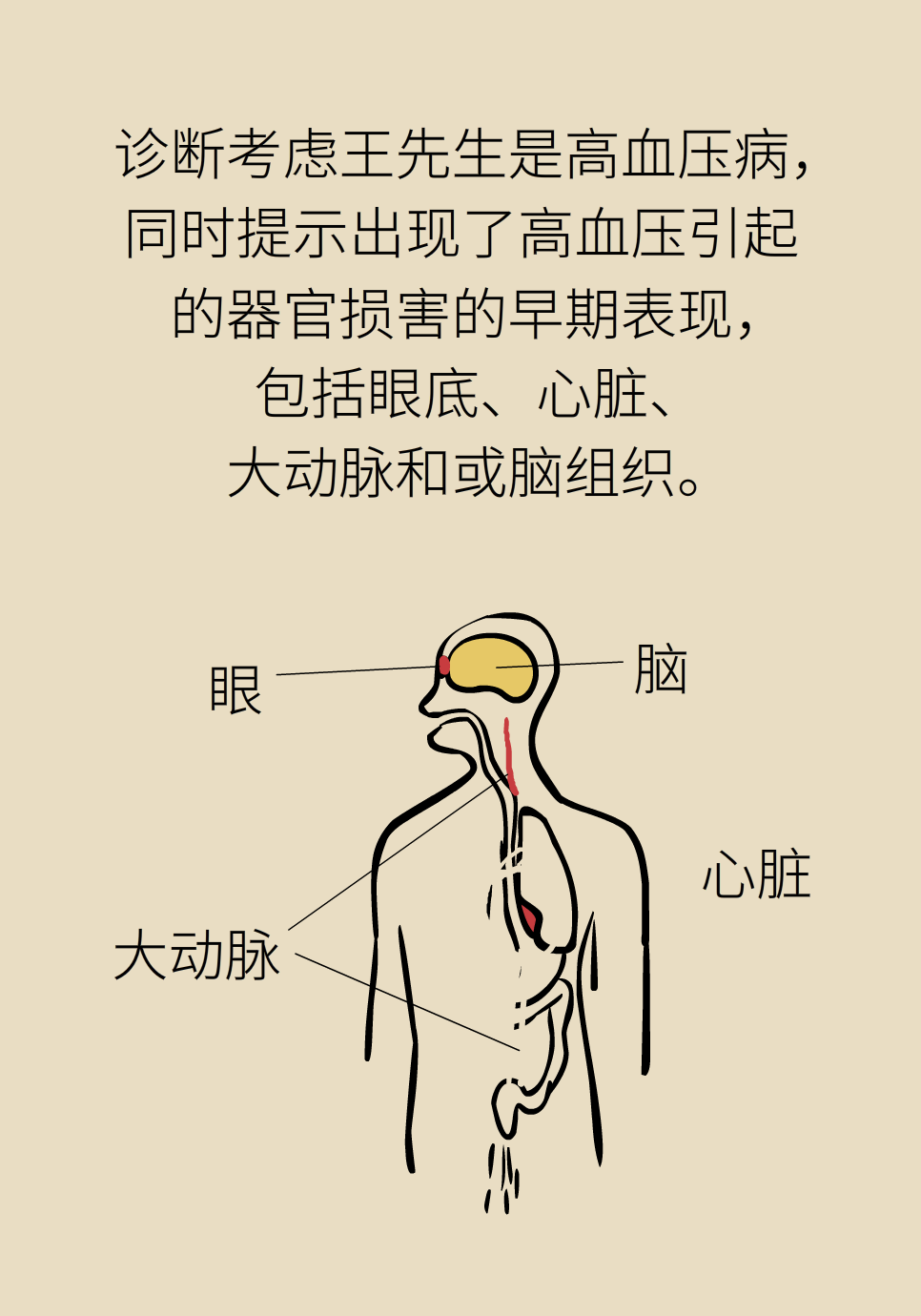 高血压医学科普