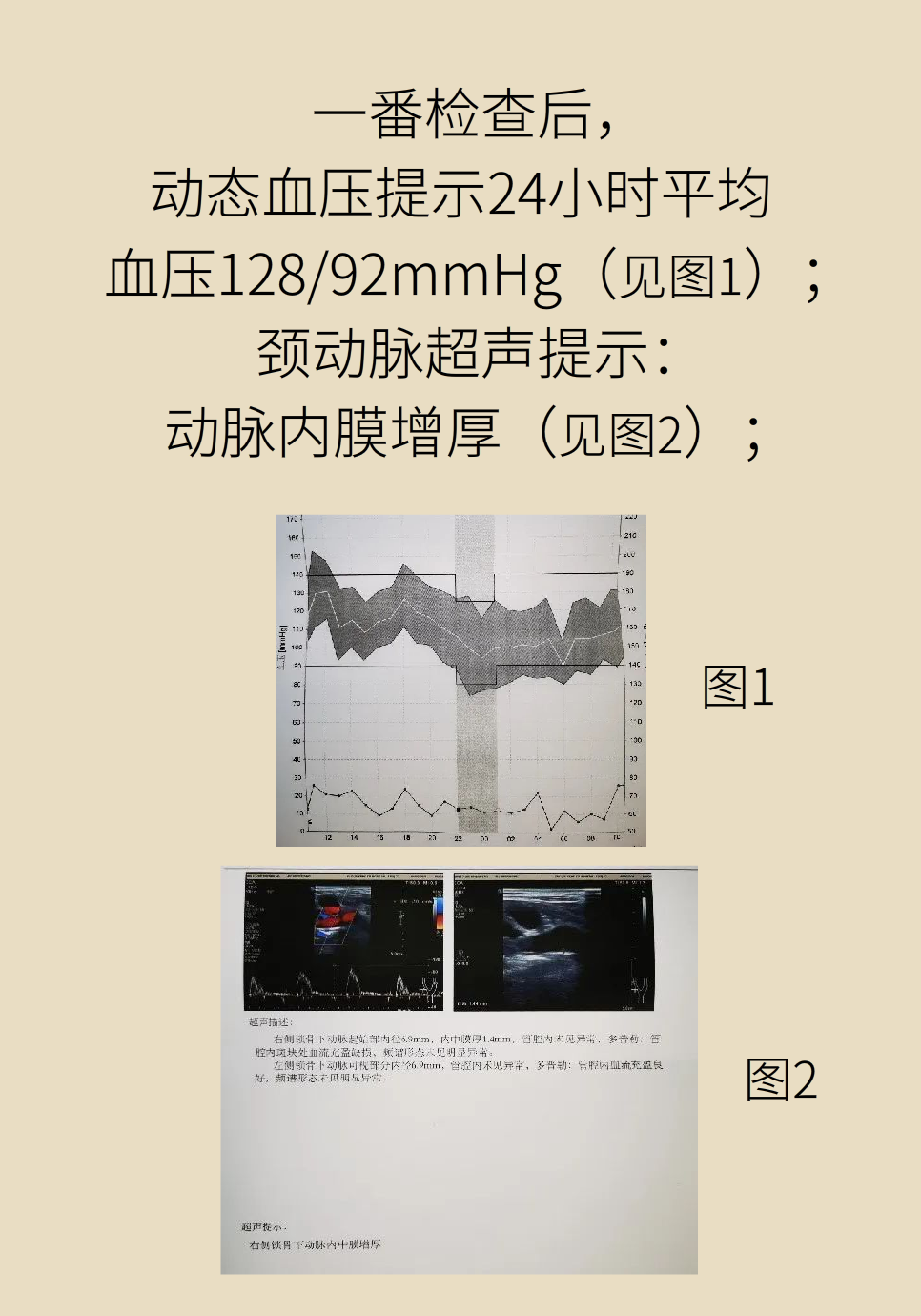 高血压医学科普