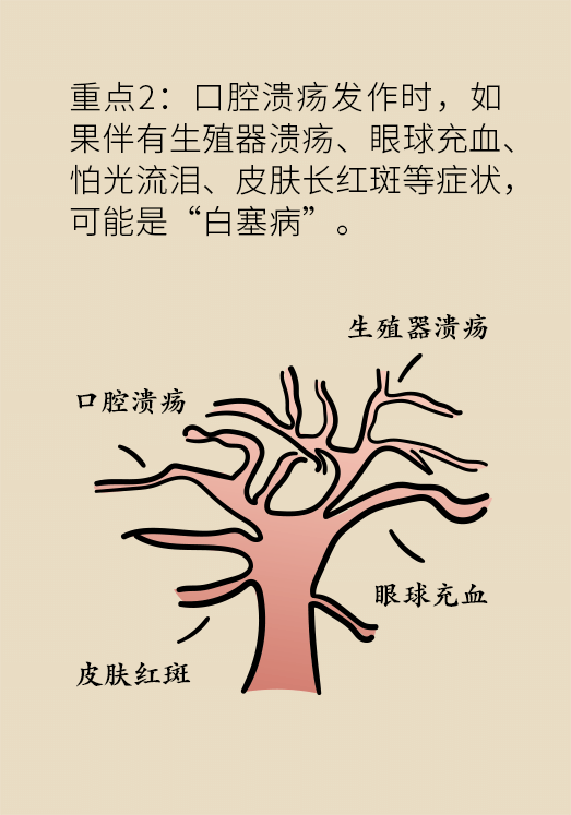 口腔溃疡医学知识科普动漫制作