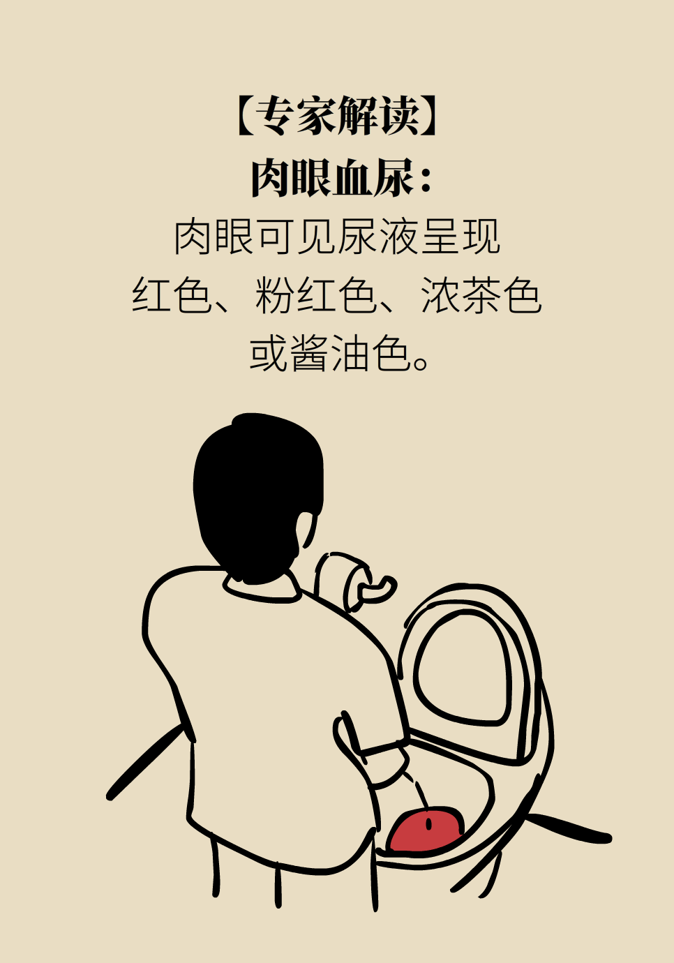 医学肾知识科普