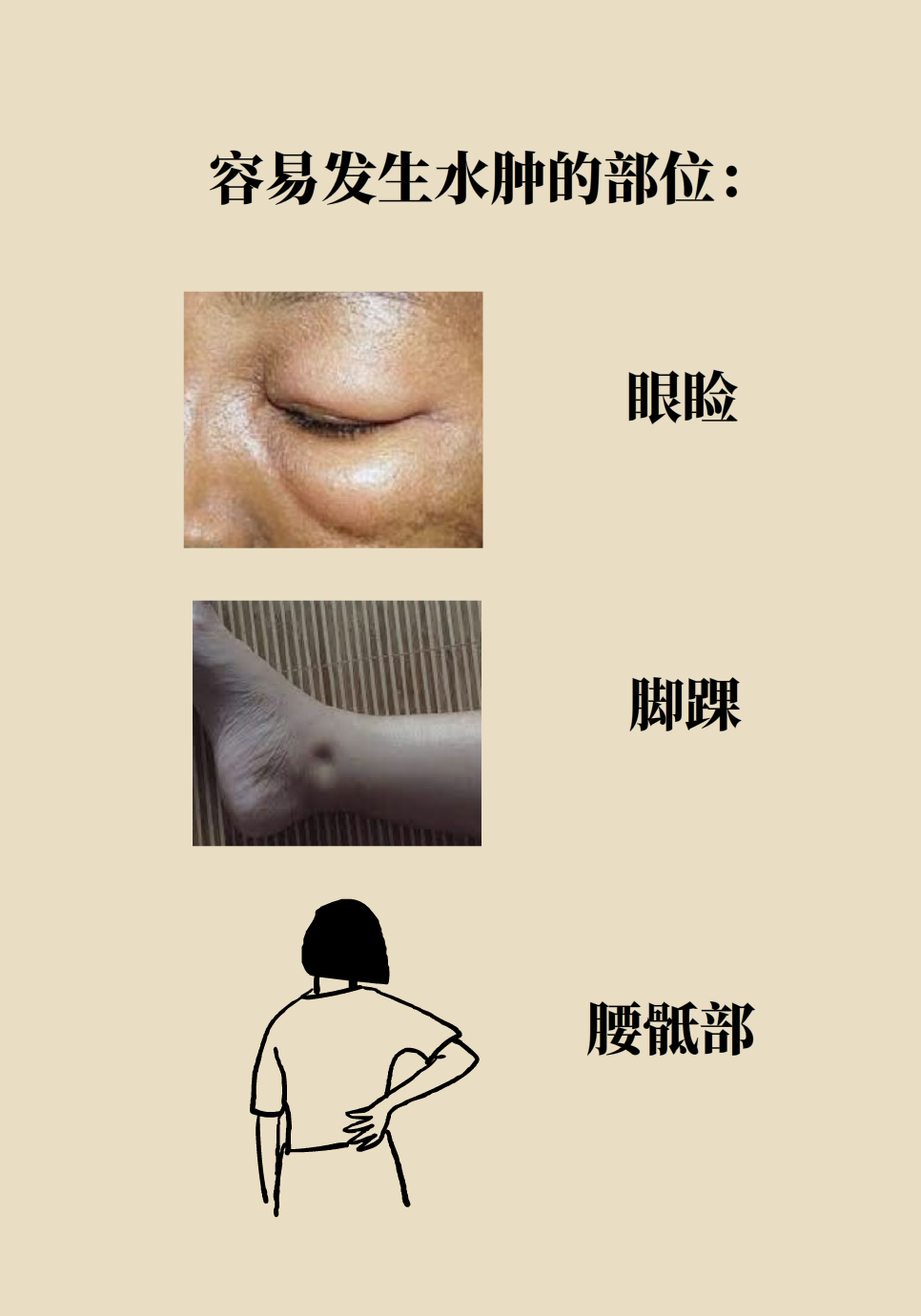 医学肾知识科普