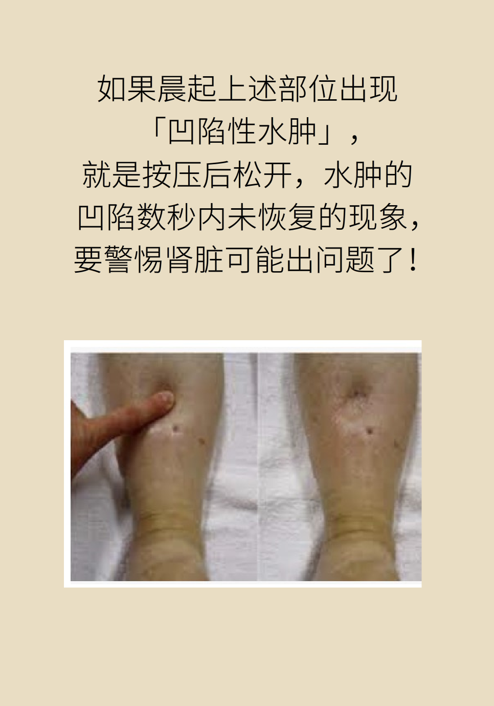 医学肾知识科普