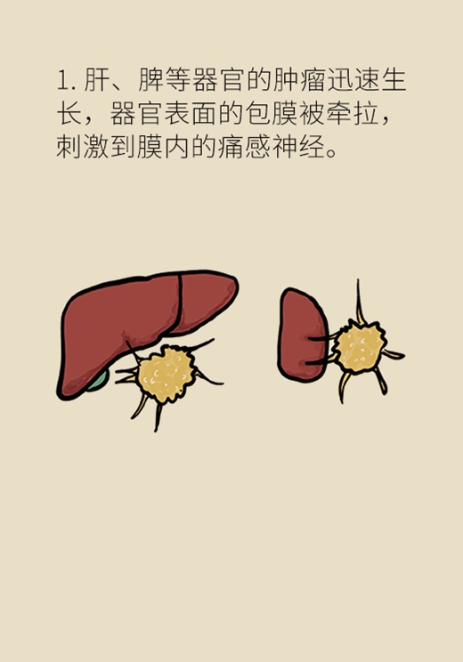 癌症医学知识科普动漫制作