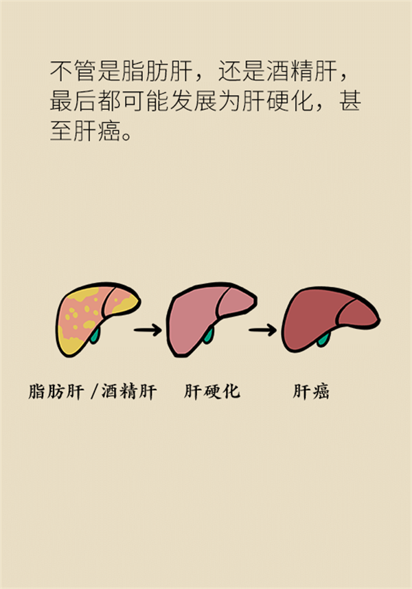 肝癌医学知识科普