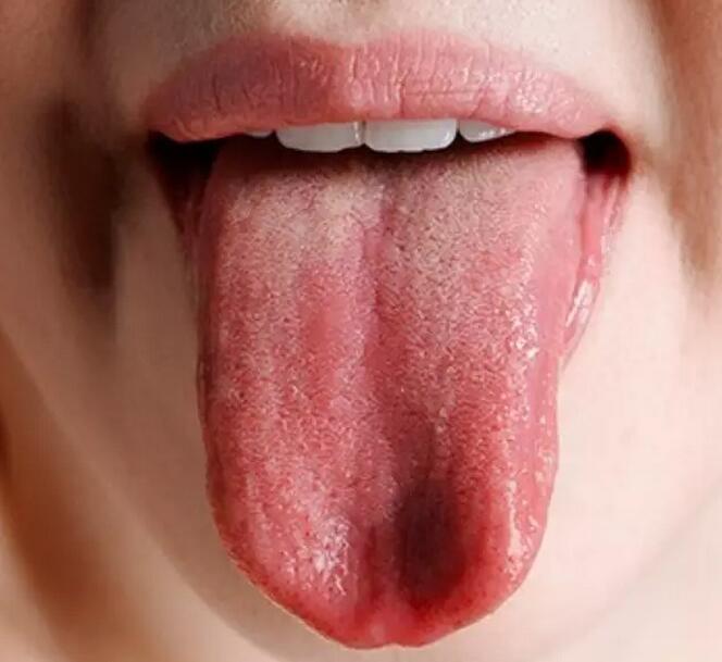 用舌头也可以“看”东西吗