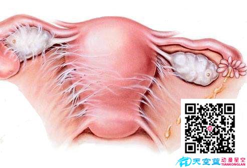 盆腔炎  症状