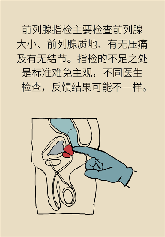 指检前列腺感觉要弯了图片