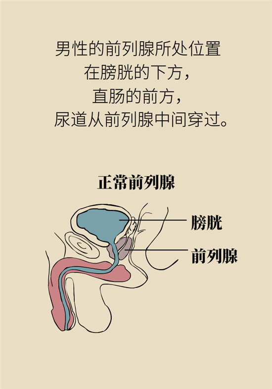 前列腺肥大了还能缩小吗？