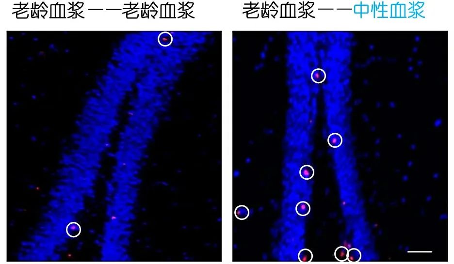 重返年轻不用大换血，只要给血液“兑点水”？