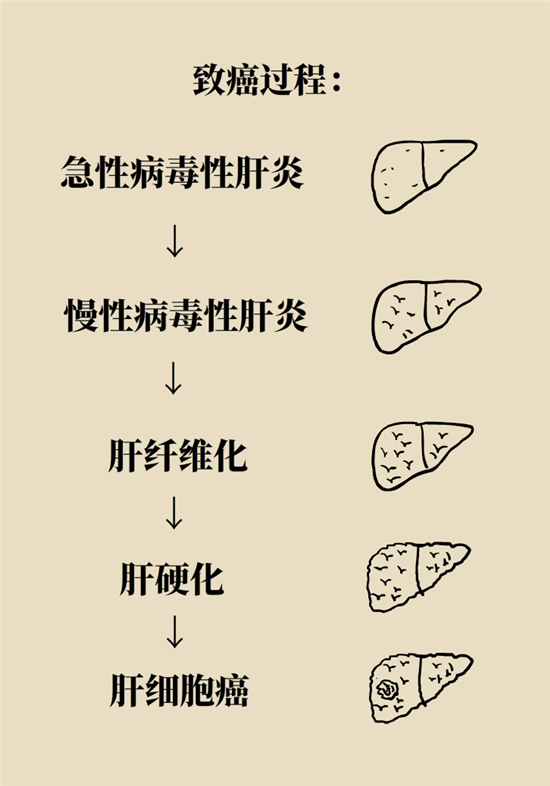 癌症会传染吗？专家：这些高危因素得注意