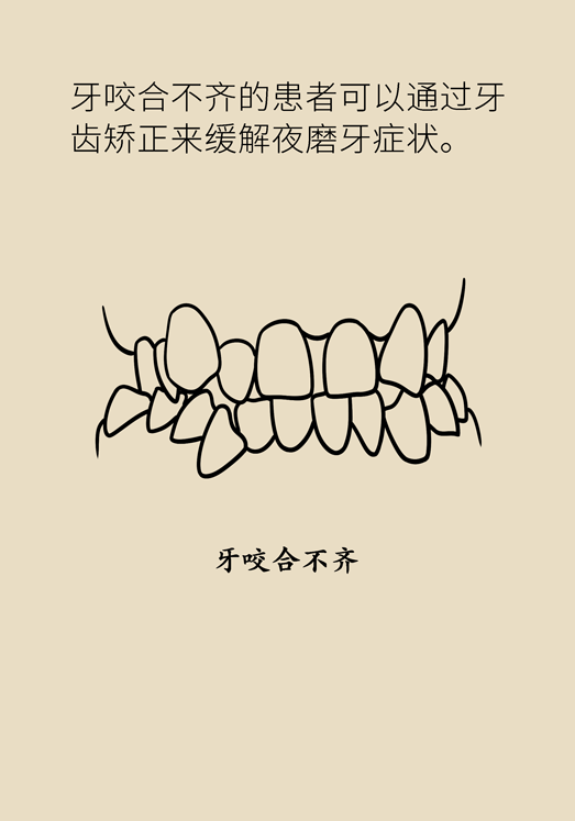 磨牙