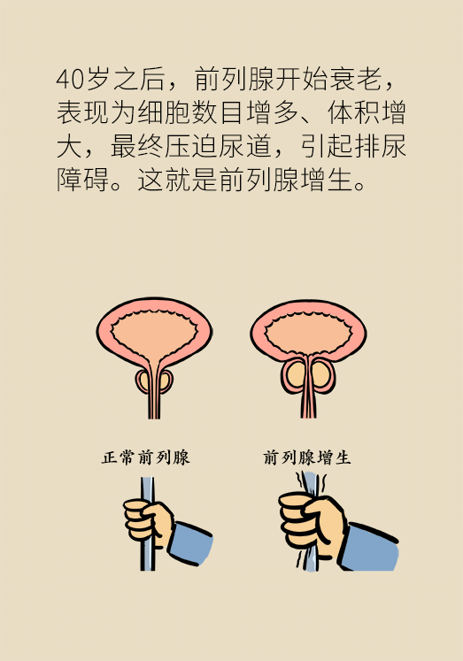 前列腺科普动漫制作