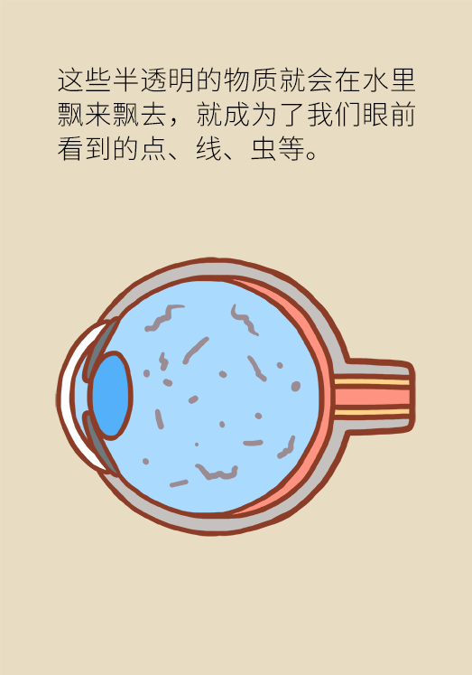 眼科医学科普动漫