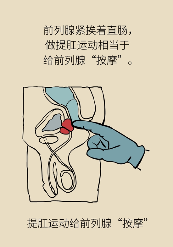 怎么做可以预防痔疮呢？按摩前列腺、锻炼盆底肌