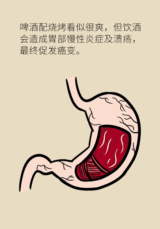 胃癌医学动漫制作